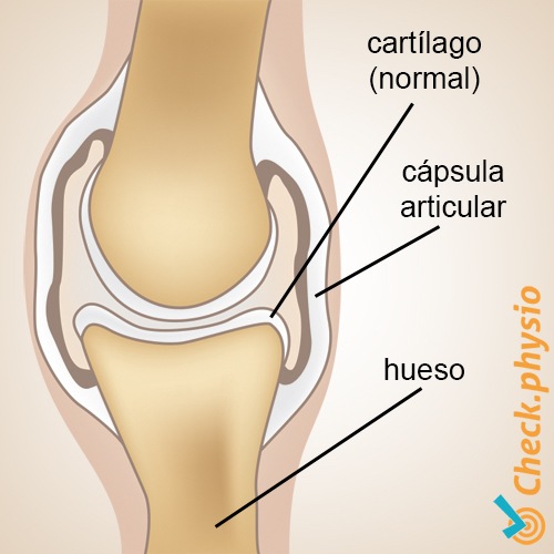 artrosis anatomía saludable