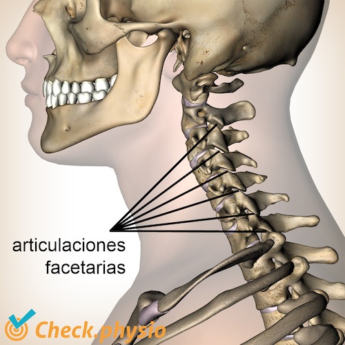 Síndrome facetario cervical | Physio Check