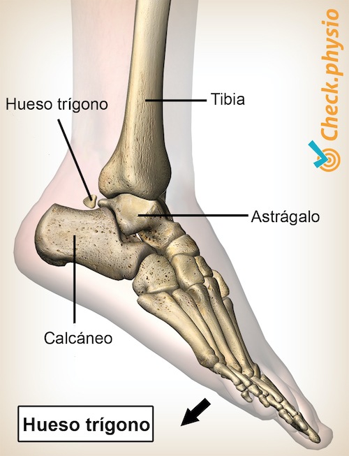 pinzamiento posterior del tobillo hueso trígono