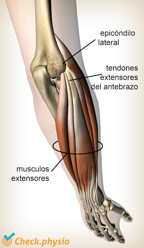 extensores del brazo